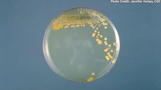 Cronobacter sakazakii developing on a petri dish.
